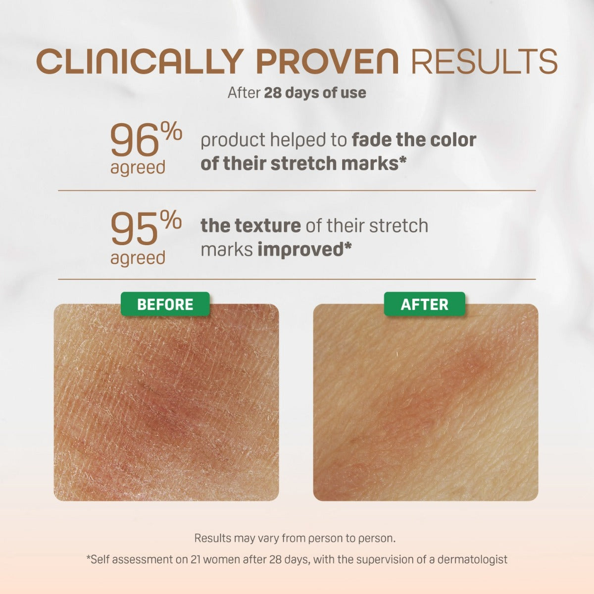 MATERNITY STRETCH MARKS SERUM 40ML